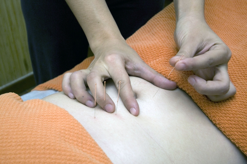 osteopathe-SALLAGRIFFON-min_acupuncture-4175625